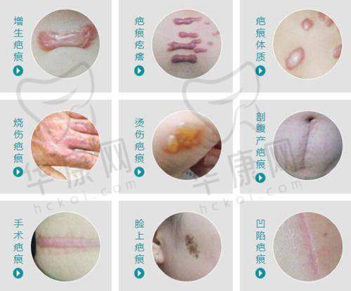 选择西安壹加壹医疗美容医院王俊河大腿吸脂的理由
