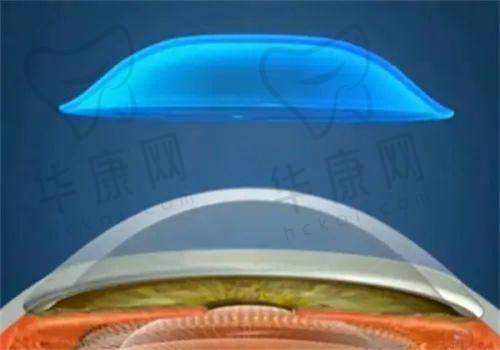 周口中视眼科医院刘建君医生资质信息