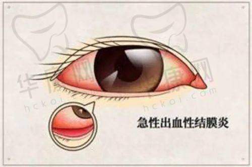 10. 成都悦瞳眼科医院
