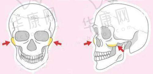 包头华美医疗美容医院正规吗？