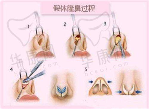 广州韩妃的特色项目展现私立优势