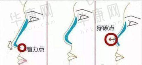 深圳今喜医疗美容门诊部患者评价