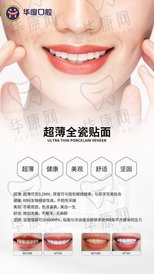 重庆贝乐嘉口腔医院医生在E-Max瓷贴面项目的优势