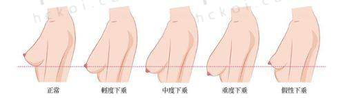 谢雯院长擅长项目