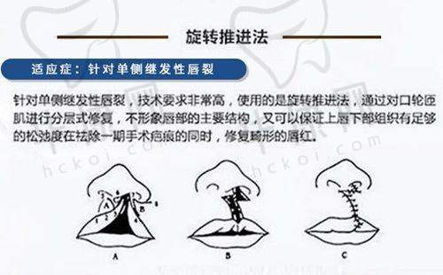 术后修复的成效
