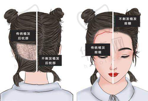 武汉光泽皇后医疗美容沈海林医生预约方式