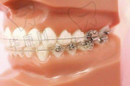 4. 黑龙江美植口腔