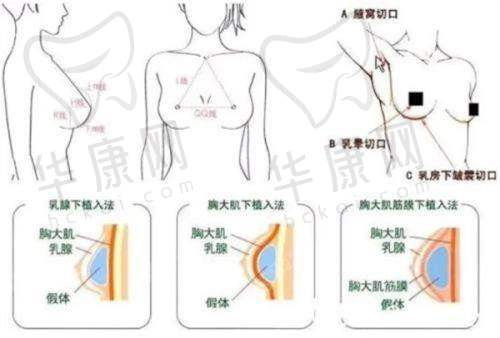 怎样能让热拉提成效更好?