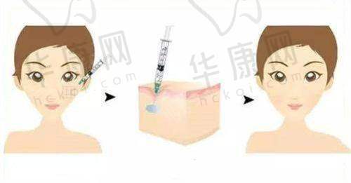 陈赖婷医生擅长项目