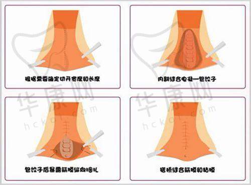 周口川汇芳艺一美医疗美容诊所基本资料：