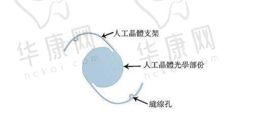 无锡丽都整形美容医院陈光平肋软骨隆鼻的成功实例