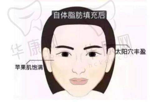 蔡灵医生特色技术优势