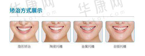 长春爱馨口腔张立月正雅经典版隐形矫正15000元起，专业正畸超划算！