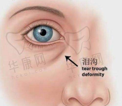 烟台壹美天成医疗美容医院全方面部自体脂肪填充的未来展望