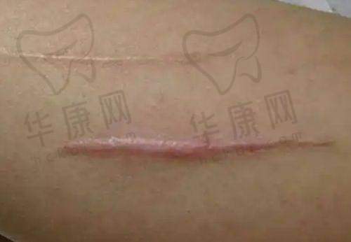 义乌秀壹医疗美容门诊部怎么样？医院的详细介绍