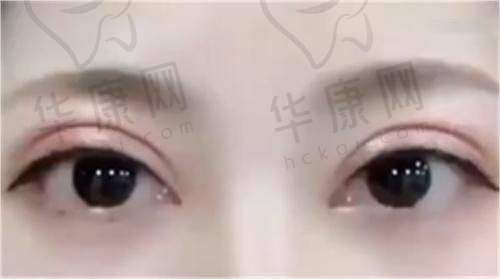 吉大一院整形科疤痕修复科室实力如何?