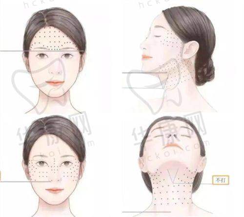 襄阳韩美医疗美容医院在双眼皮项目上的特色优势