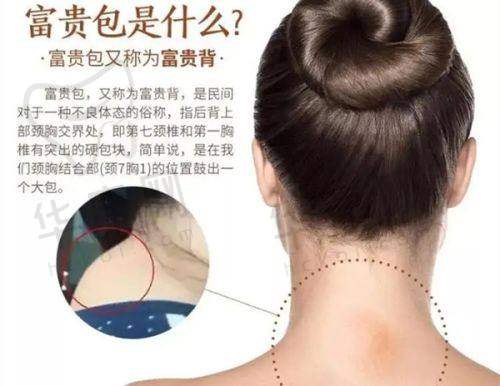孙梅医生特色技术优势