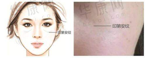 深圳后海安美聚光医疗美容彭喜医生预约方式