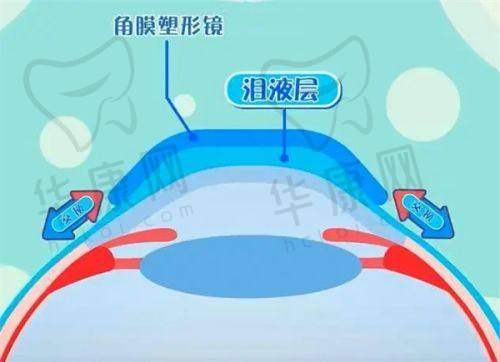 贵阳康视眼科医院到底怎么样？