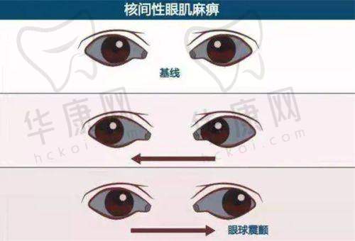 多焦点晶体的特点又是怎样的呢?