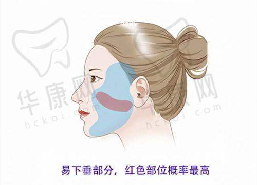 全切双眼皮术后不同阶段的化妆建议是怎样的?