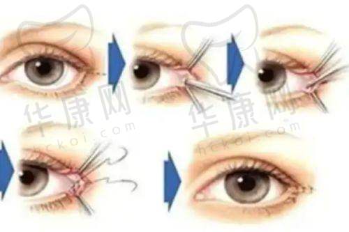 中山韩妃医疗美容刘健鼻部整形价格体系