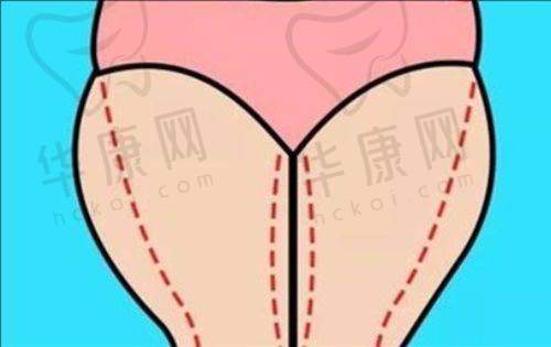 陈光平医生预约方式
