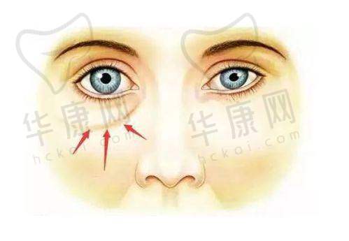 深圳画美整形王志东的价格参考