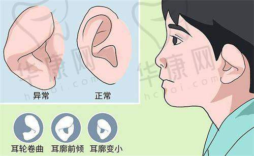 中山大学附属第三医院做缩胸手术优势几何?