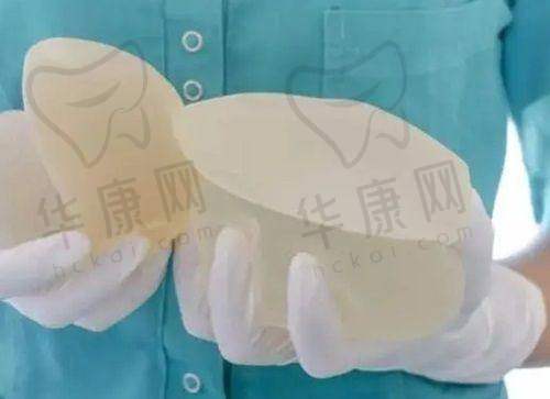 深圳画美整形王志东的真实实例