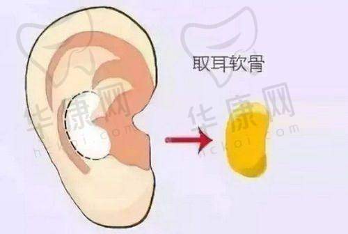 广东省人民医院做缩胸手术有什么特色?