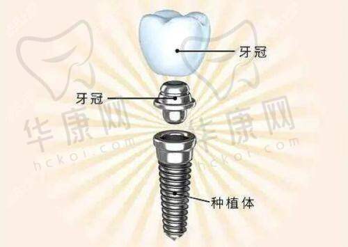 这些私立口腔医院为何便宜又弄得好？