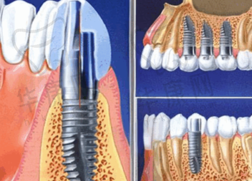 天津蓟州京医口腔医院开业了，收费标准贵吗？
