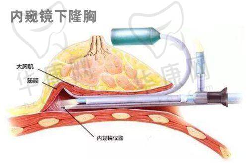深圳画美医疗美容医院的价格与口碑