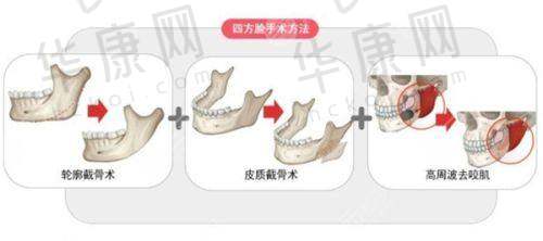 与其他医院项目对比优势