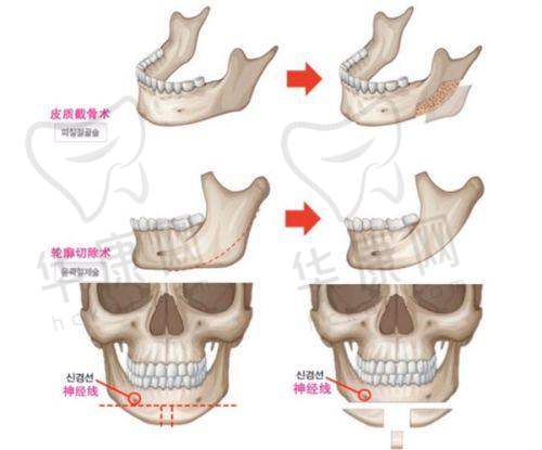 对昆山玥美医疗美容和胡慧敏医生的信赖
