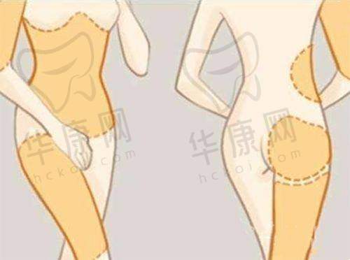 北京广济医院疤痕科正规吗？