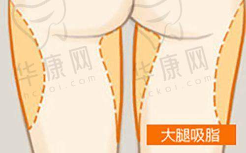 深圳正规十大整形医院排名榜里各医院有哪些特色专科和医生？