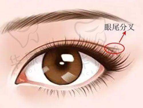 与太原其他双眼皮修复医生的对比优势