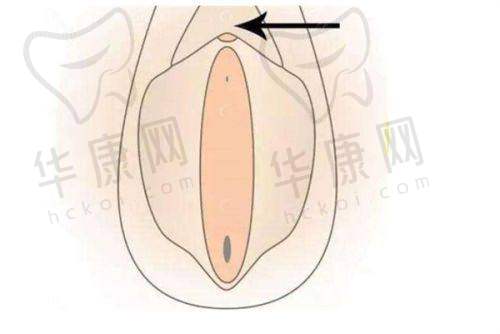 合肥市第(1):吸脂实力究竟如何?