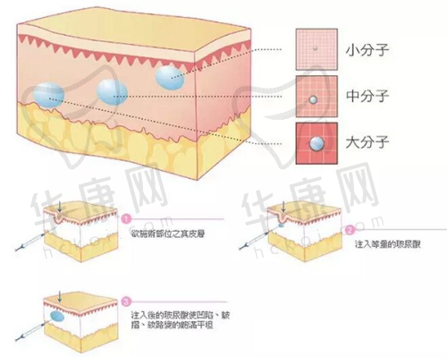 确定方案，期待改变