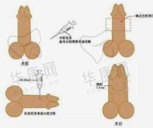 赣州华美医疗美容的可靠之处