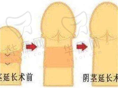 苏州乐桥疤痕胎记皮肤医院地址电话：
