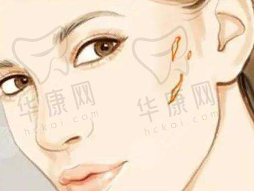 治疗后的显著成效