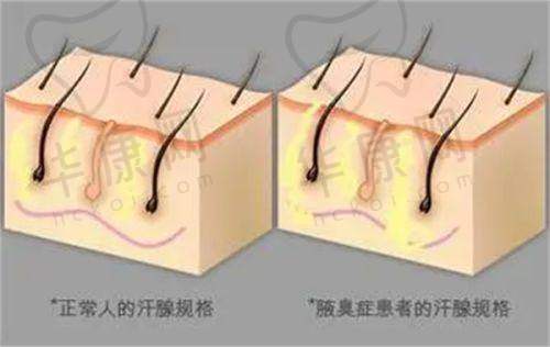 黑龙江瑞丽医疗美容医院张旭光医生特色技术优势