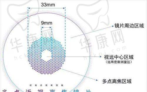 济南华视眼科医院是私立医院吗？是的！正规靠谱、价格亲民值得信赖