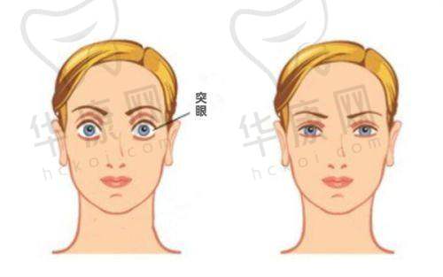 北京希玛林顺潮眼科医院在准分子激光手术方面的特色优势