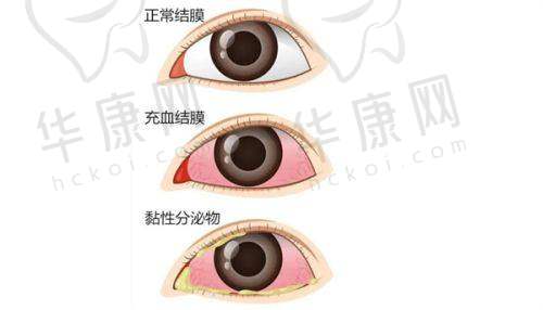 术中：低痛感与不错技艺