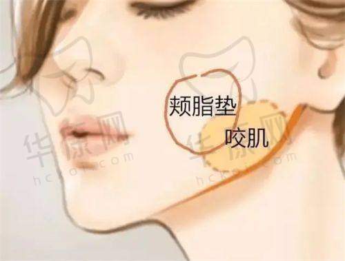 整形医院的筋膜提升有什么独特之处？